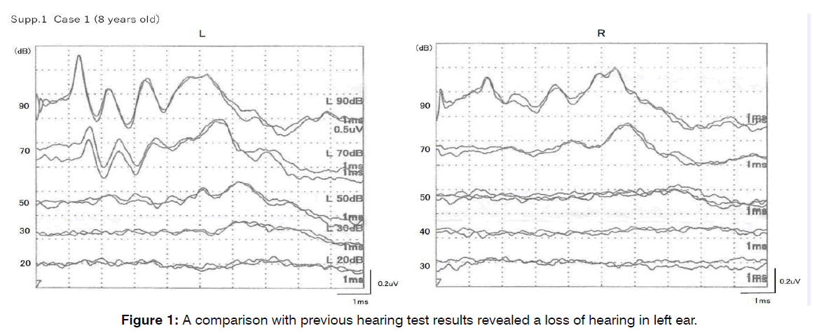 tinnitus-control-groups