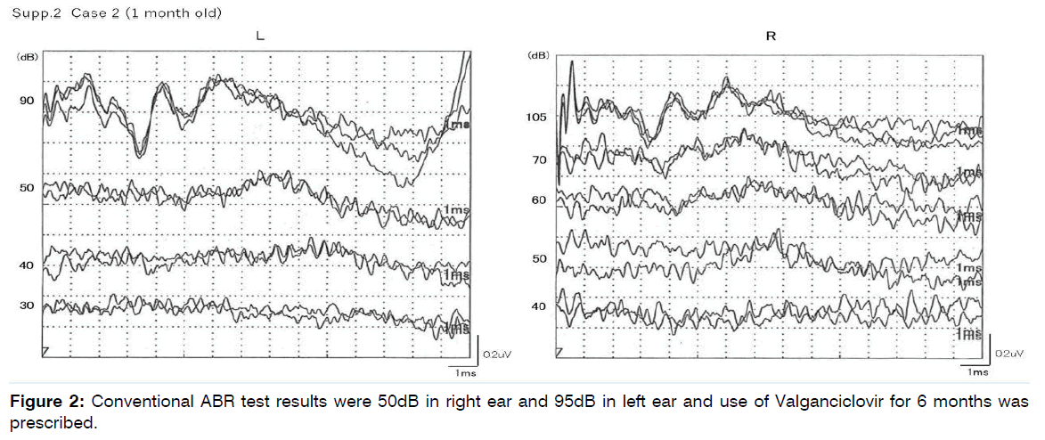 tinnitus-control-groups