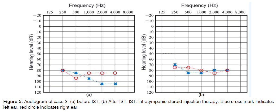 tinnitus-control-groups