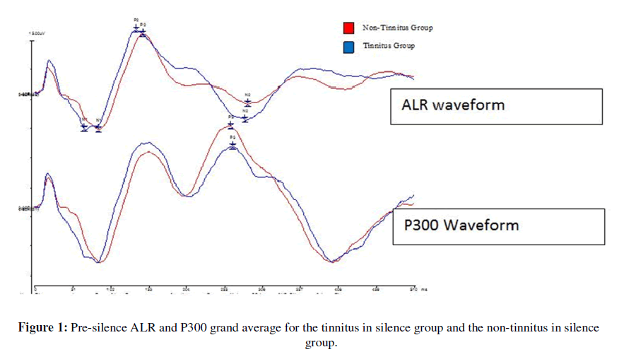 tinnitus-waveform-amplitudes-latencies