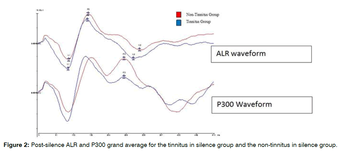 tinnitus-waveform-amplitudes-latencies
