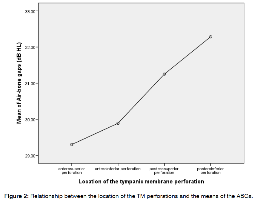 tinnitus-abnormal-audiogram-hearing-loss