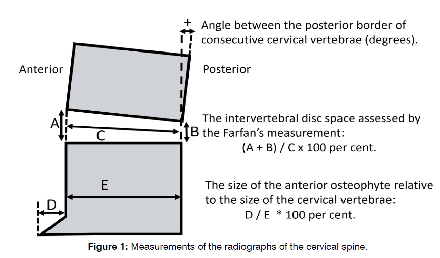 tinnitus-cervical-spine
