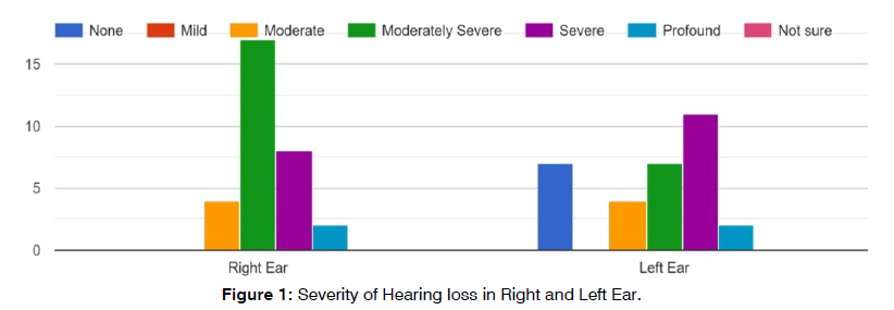 tinnitus-hearing-loss
