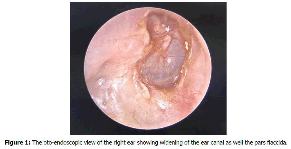 tinnitus-control-groups