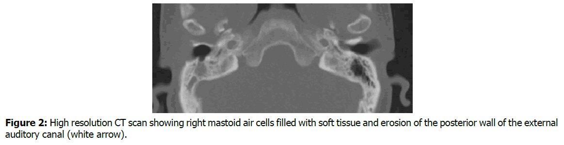 tinnitus-control-groups