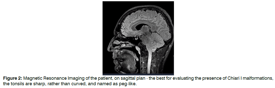 tinnitus-threshold-level