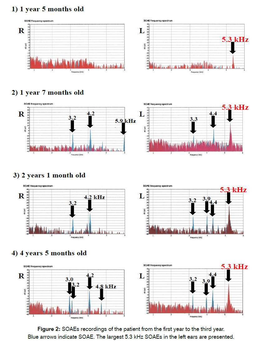 tinnitus-family-tree