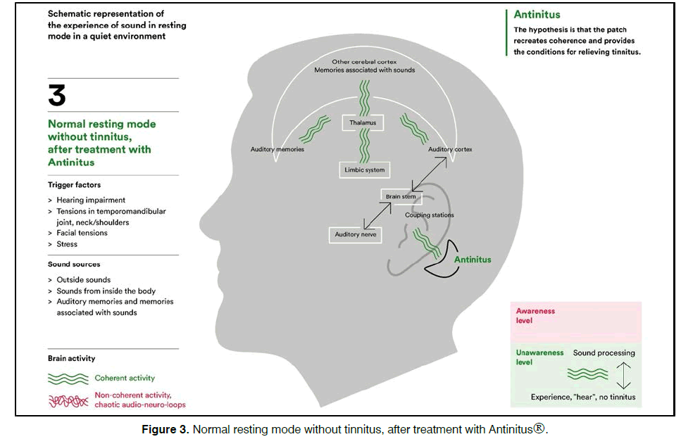 Tinnitus-Antinitus