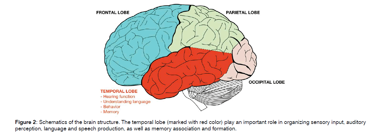 Hearing impairment is associated with cognitive decline, brain