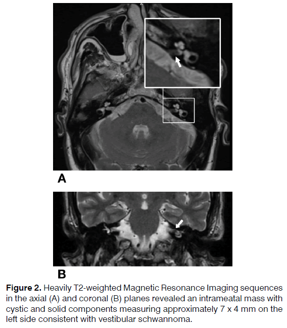 Tinnitus-Magnetic-Resonance