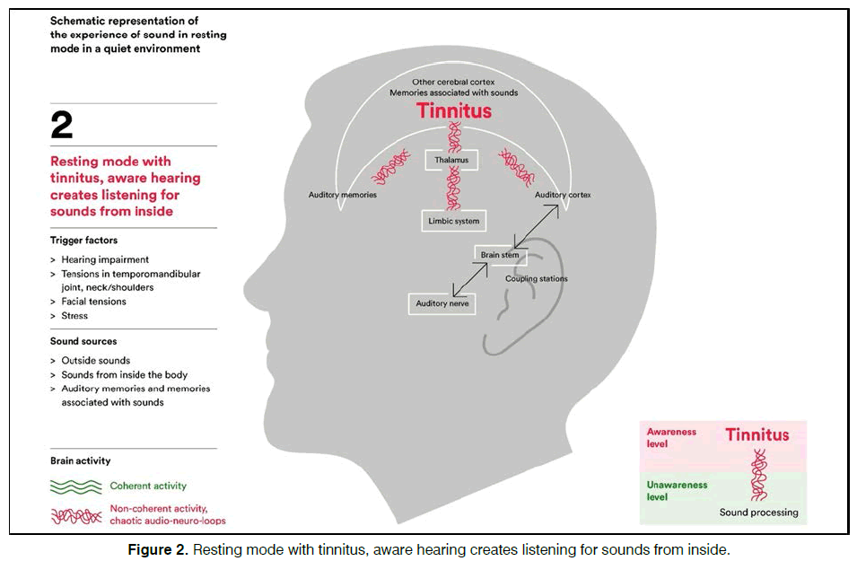 Tinnitus-Resting-mode