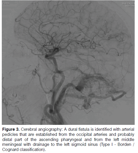 Tinnitus-angiography