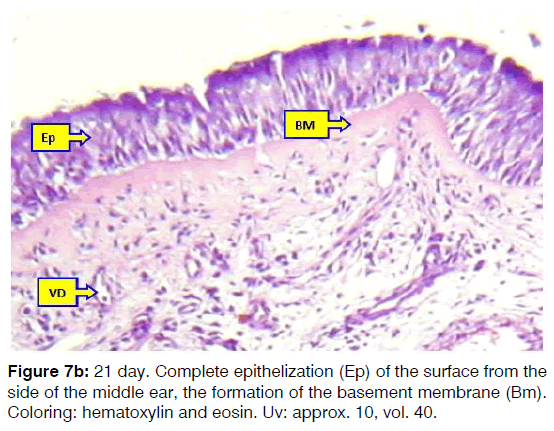 Tinnitus-basement-membrane