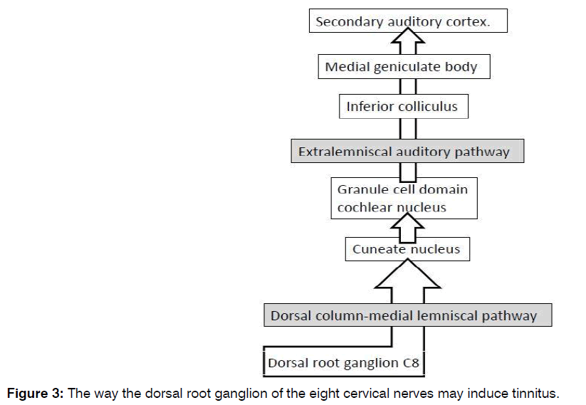 Tinnitus-cervical-nerves