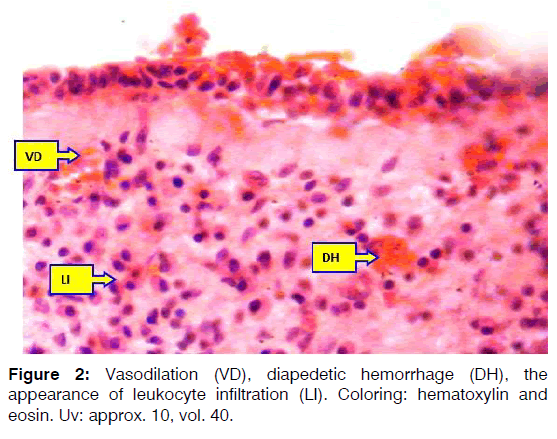 Tinnitus-diapedetic-hemorrhage