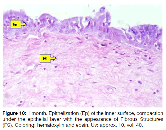 Tinnitus-epithelial-layer