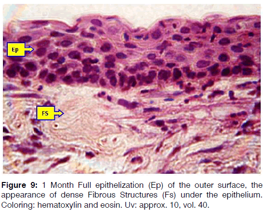 Tinnitus-fibrous-structures