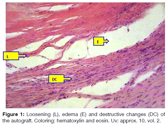 Tinnitus-hematoxylin