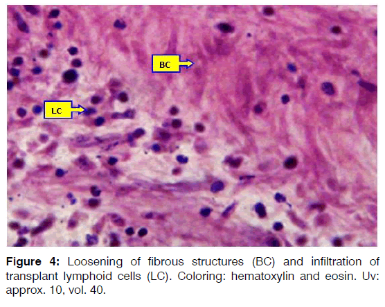 Tinnitus-lymphoid-cells