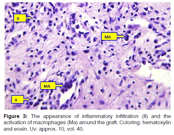 Tinnitus-macrophages