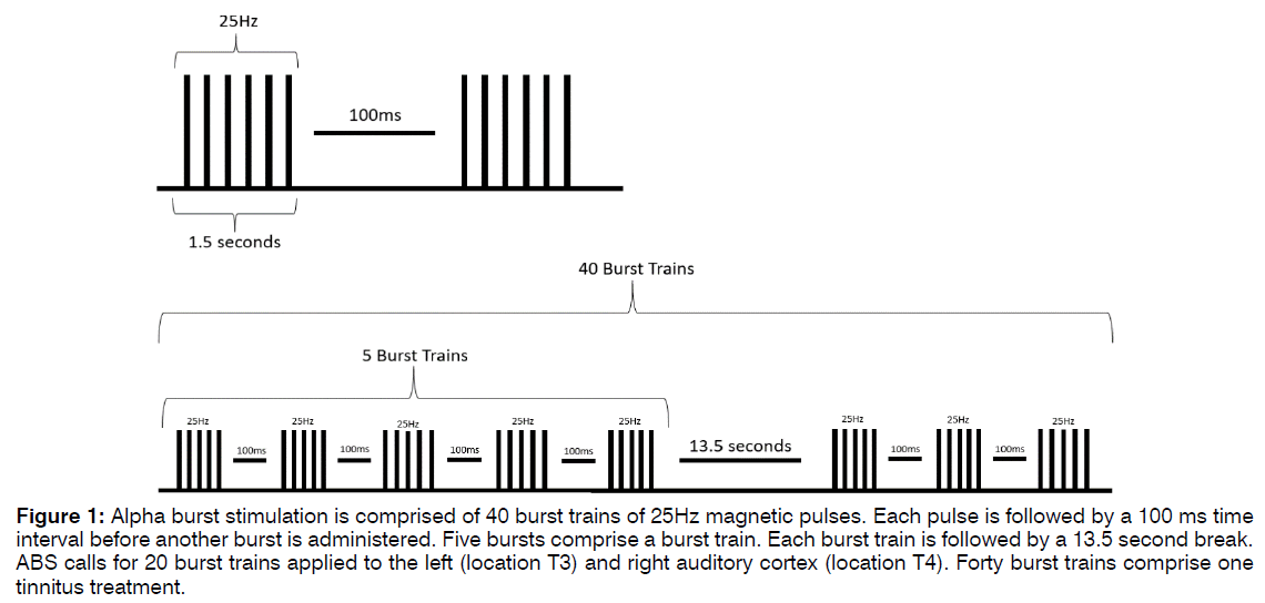 Tinnitus-magnetic-pulses