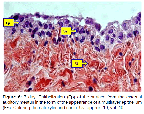 Tinnitus-multilayer-epithelium