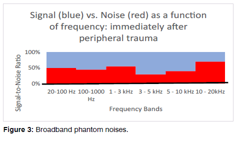 Tinnitus-phantom-noises