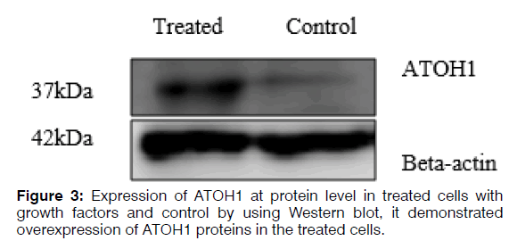 Tinnitus-protein-level