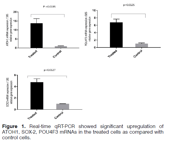 Tinnitus-significant-upregulation