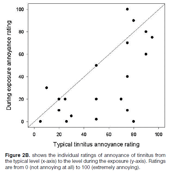 Tinnitus-typical-level