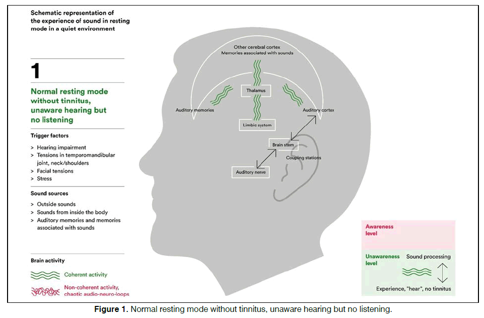 Tinnitus-unaware-hearing