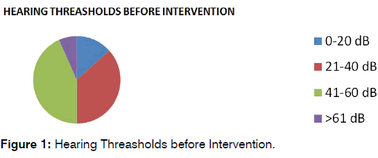 tinnitus-Hearing-Threasholds