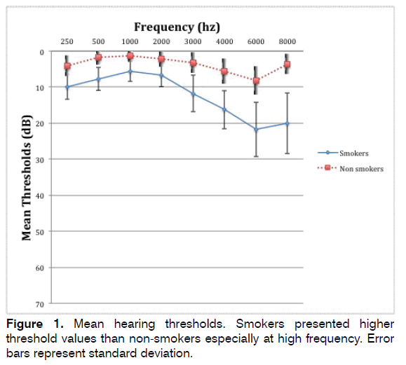 tinnitus-Mean-hearing-thresholds