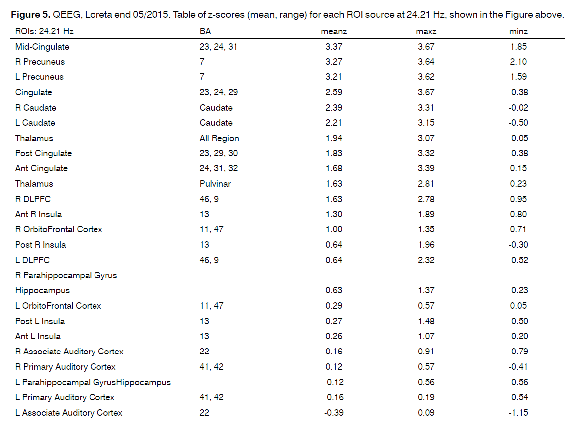 tinnitus-Table-z-scores