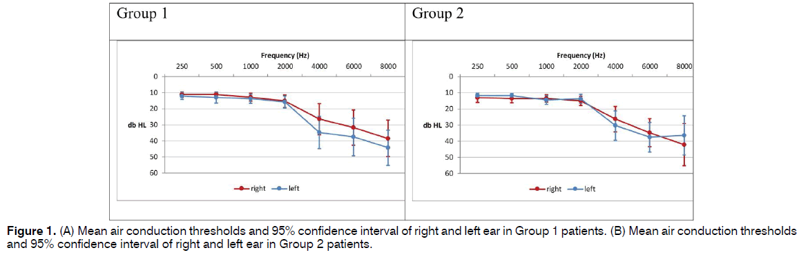 tinnitus-air-conduction-thresholds