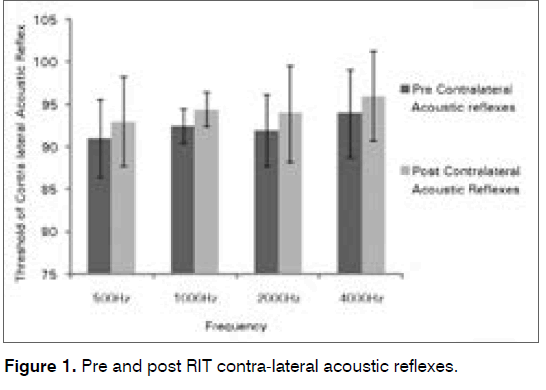 tinnitus-contra-lateral