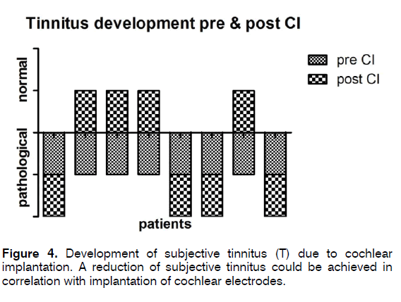 tinnitus-implantation-cochlear-electrodes