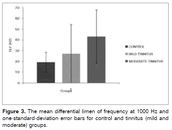 tinnitus-mean-differential-limen