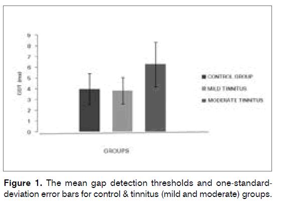 tinnitus-mean-gap-detection