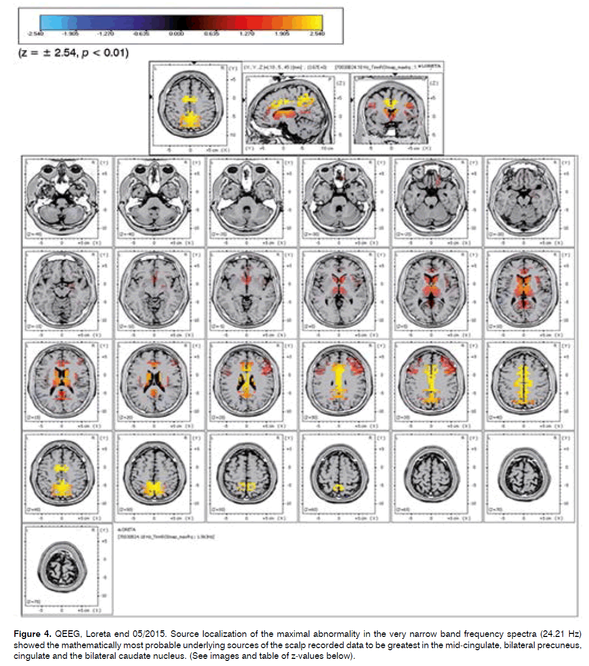 tinnitus-probable-underlying-sources