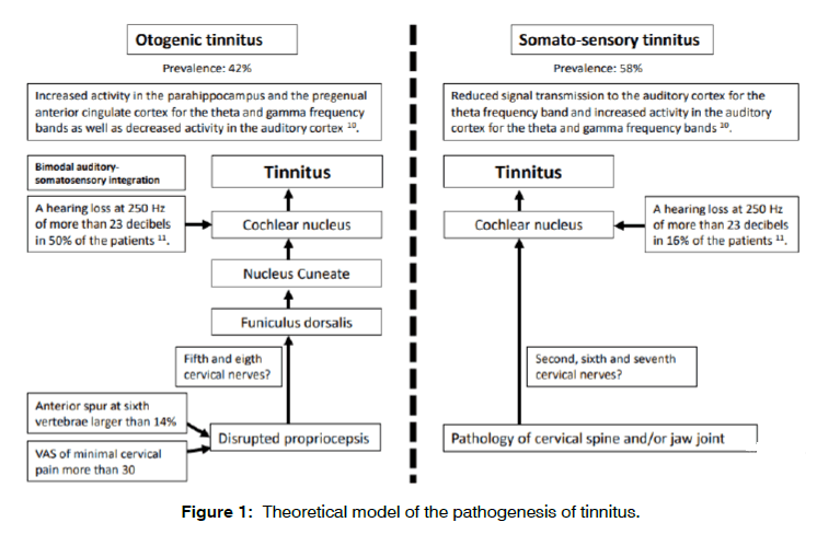 tinnitus-theoretical-model